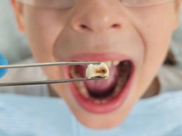 Professional Emergency Dental Service in VA